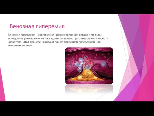 Венозная гиперемия Венозная гиперемия - увеличение кровенаполнения органа или ткани