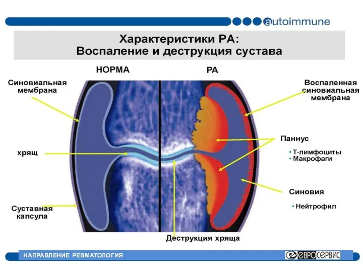 НАПРАВЛЕНИЕ РЕВМАТОЛОГИЯ