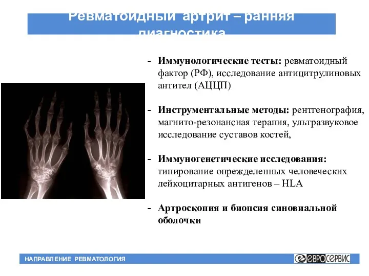 Ревматоидный артрит – ранняя диагностика НАПРАВЛЕНИЕ РЕВМАТОЛОГИЯ Иммунологические тесты: ревматоидный