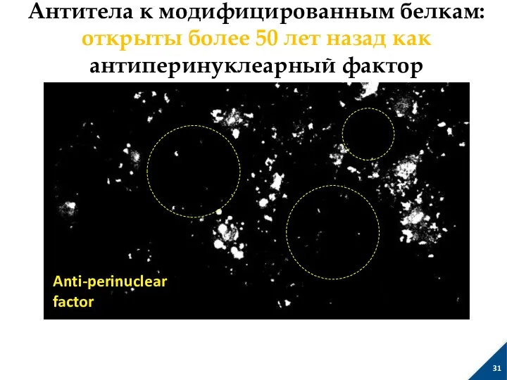 Антитела к модифицированным белкам: открыты более 50 лет назад как