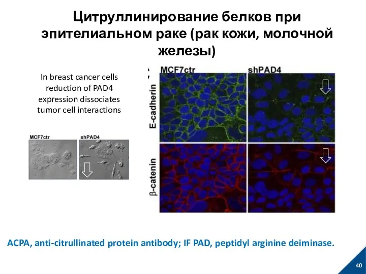 Цитруллинирование белков при эпителиальном раке (рак кожи, молочной железы) In
