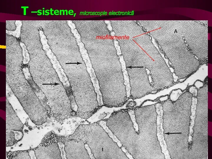 T –sisteme, microscopie electronică miofilamente