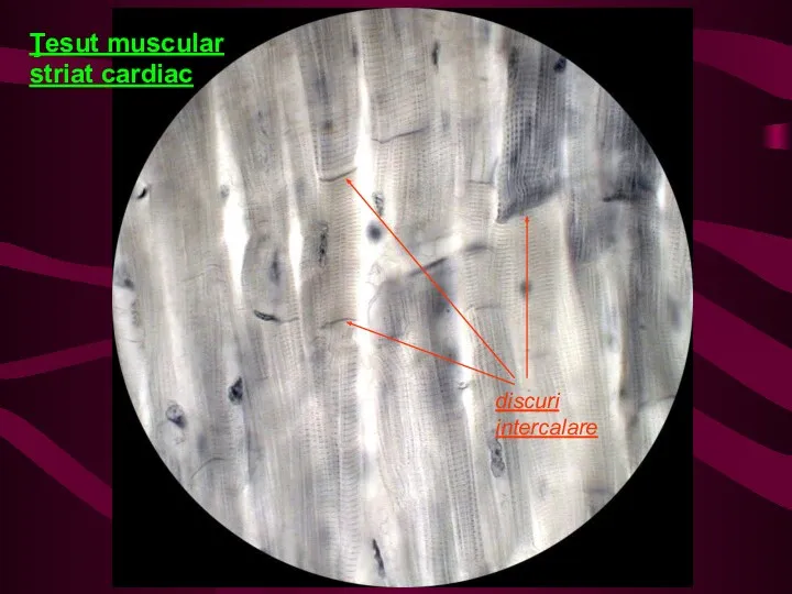 Ţesut muscular striat cardiac discuri intercalare