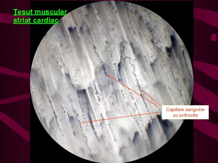 Ţesut muscular striat cardiac Capilare sangvine cu eritrocite