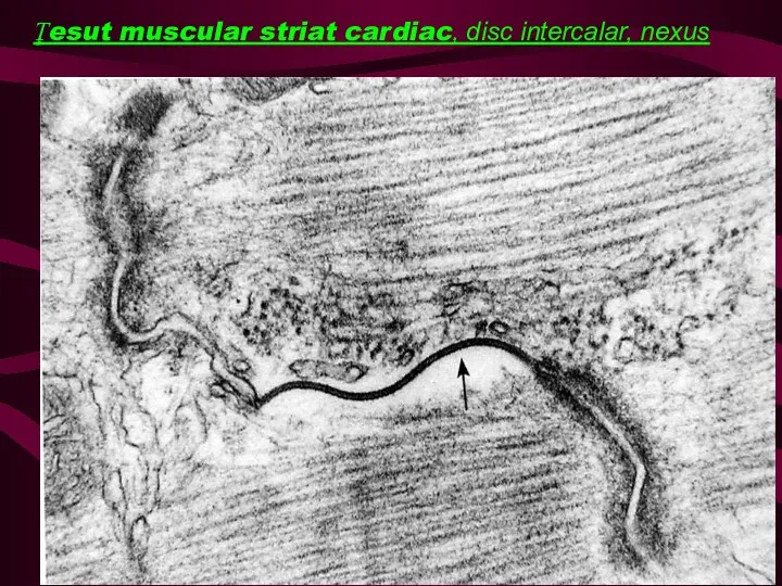 Ţesut muscular striat cardiac, disc intercalar, nexus