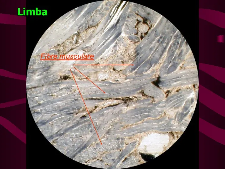 Limba Fibre musculare