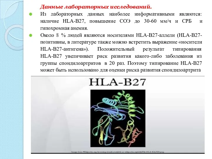 Данные лабораторных исследований. Из лабораторных данных наиболее информативными являются: наличие HLA-B27, повышение СОЭ