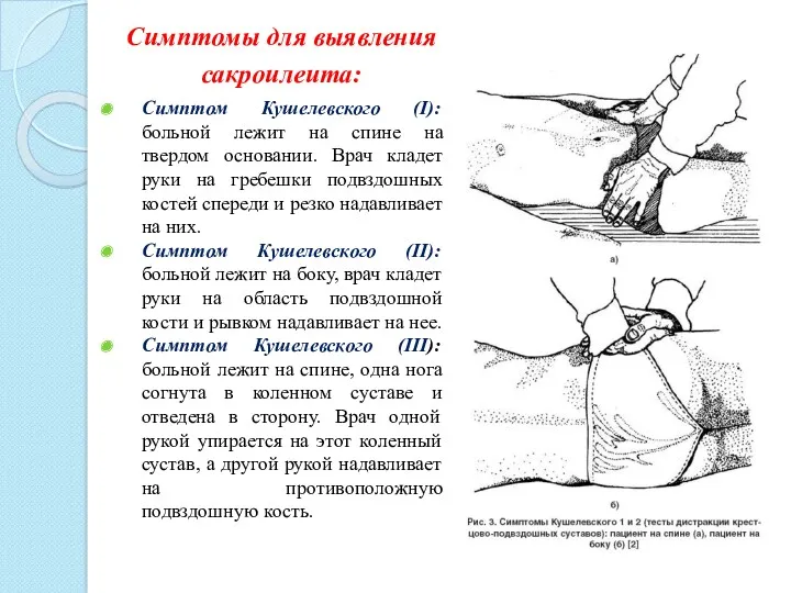 Симптомы для выявления сакроилеита: Симптом Кушелевского (I): больной лежит на спине на твердом