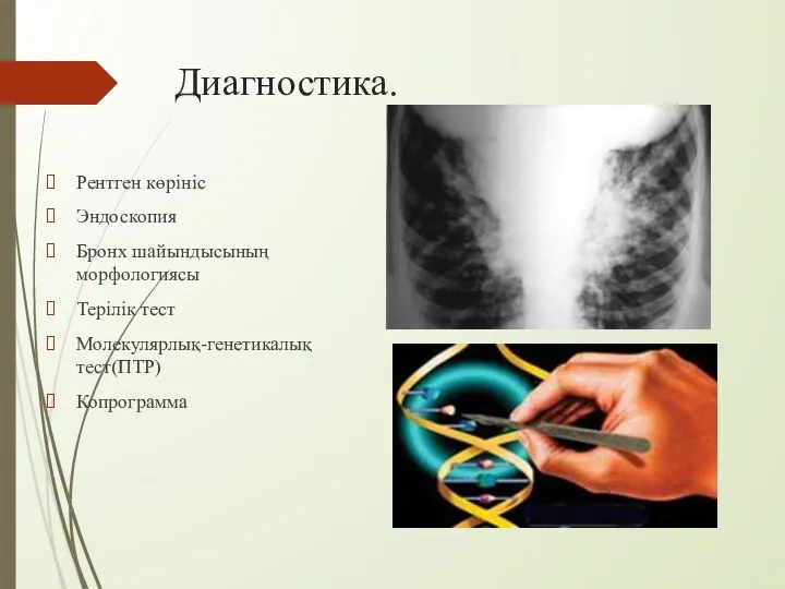 Диагностика. Рентген көрініс Эндоскопия Бронх шайындысының морфологиясы Терілік тест Молекулярлық-генетикалық тест(ПТР) Копрограмма