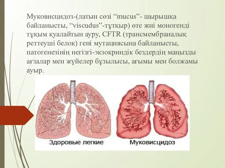 Муковисцидоз-(латын сөзі “mucus”- шырышқа байланысты, “viscudus”-тұтқыр) өте жиі моногенді тұқым