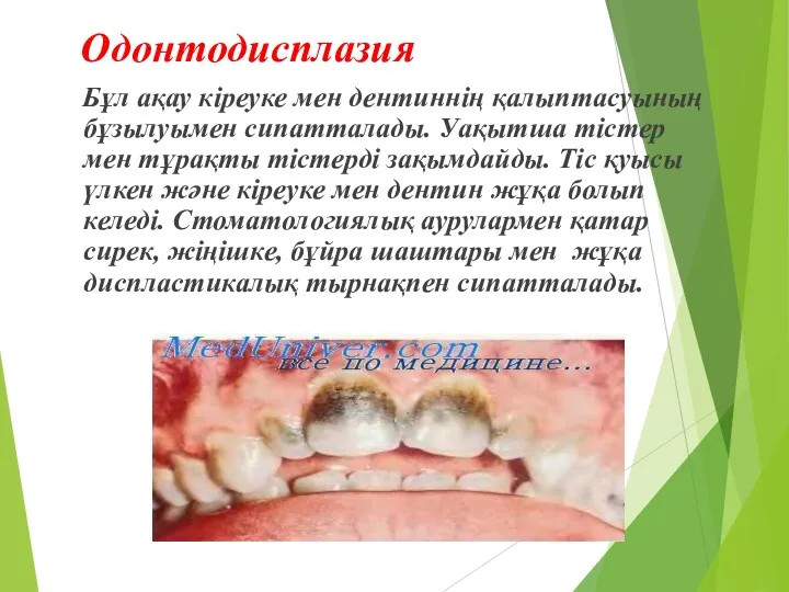 Одонтодисплазия Бұл ақау кіреуке мен дентиннің қалыптасуының бұзылуымен сипатталады. Уақытша