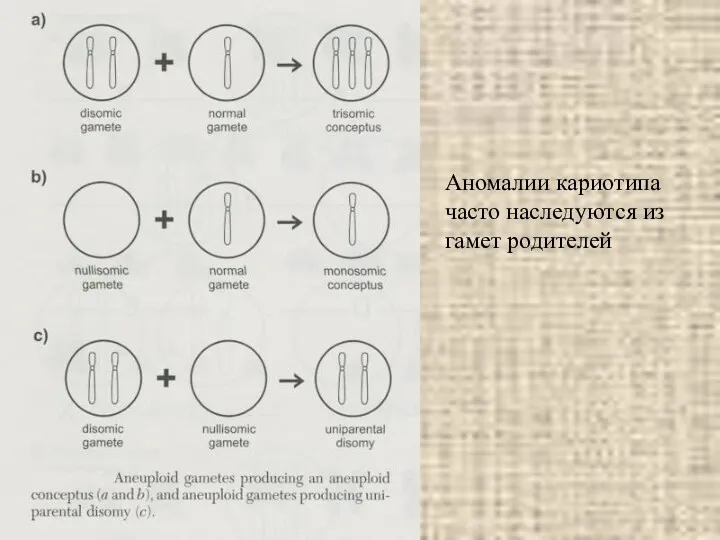 Аномалии кариотипа часто наследуются из гамет родителей