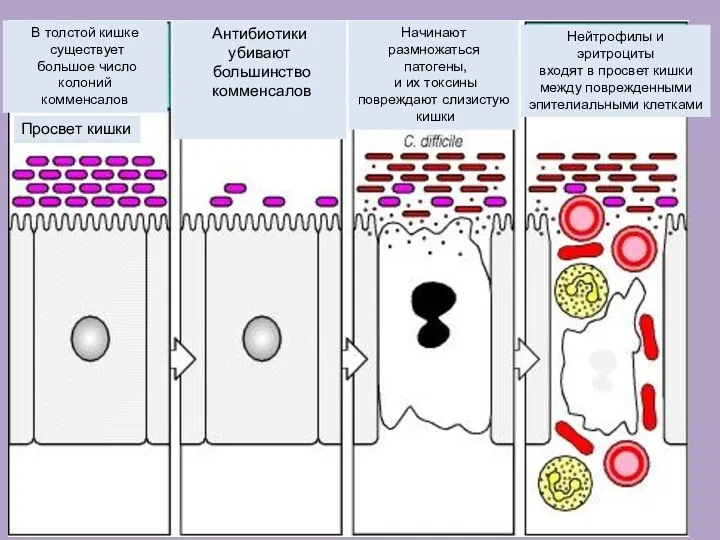 В толстой кишке существует большое число колоний комменсалов Просвет кишки
