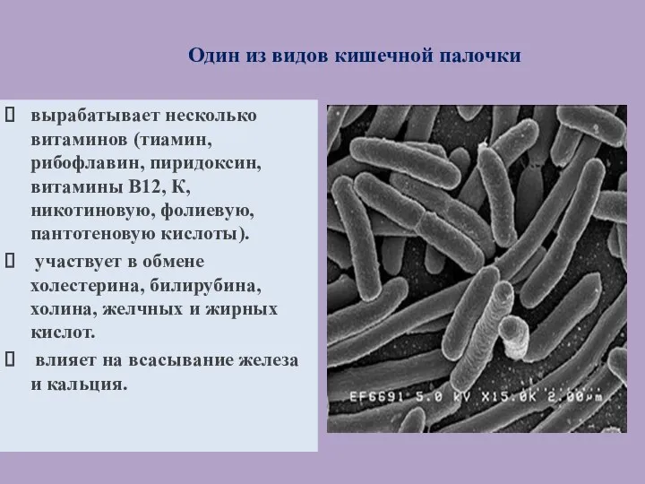 Один из видов кишечной палочки Один из видов кишечной палочки: