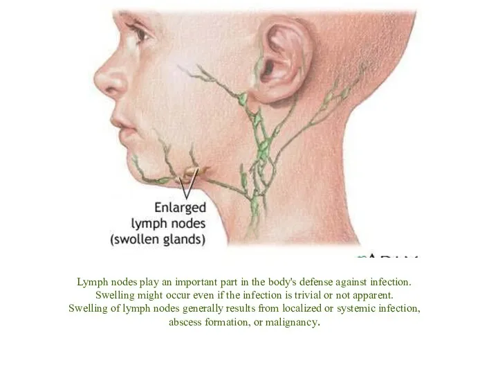 Lymph nodes play an important part in the body's defense