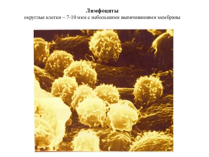Лимфоциты округлые клетки ~ 7-10 мкм с небольшими выпячиваниями мембраны