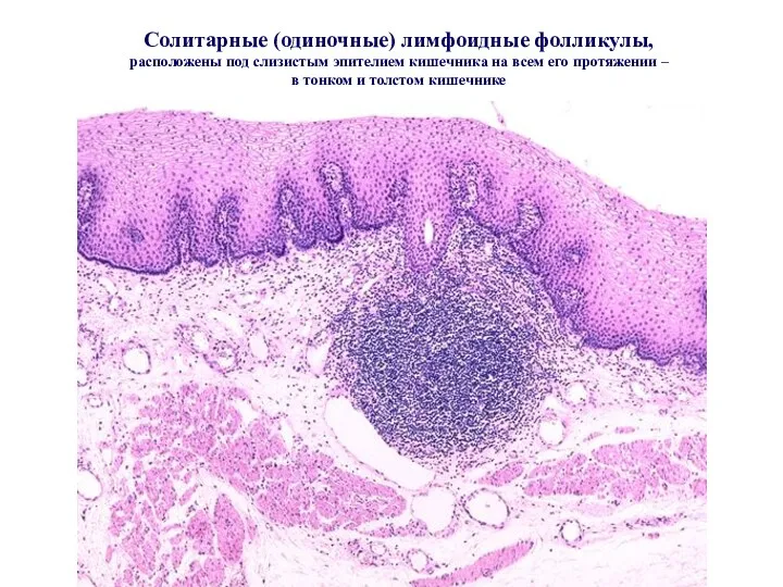 Солитарные (одиночные) лимфоидные фолликулы, расположены под слизистым эпителием кишечника на