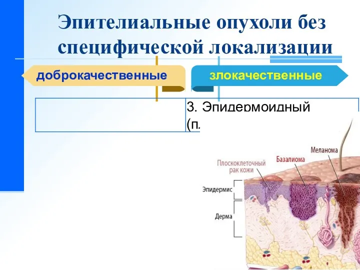 Эпителиальные опухоли без специфической локализации доброкачественные