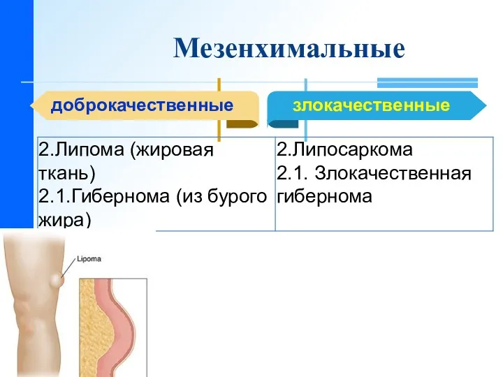 Мезенхимальные доброкачественные