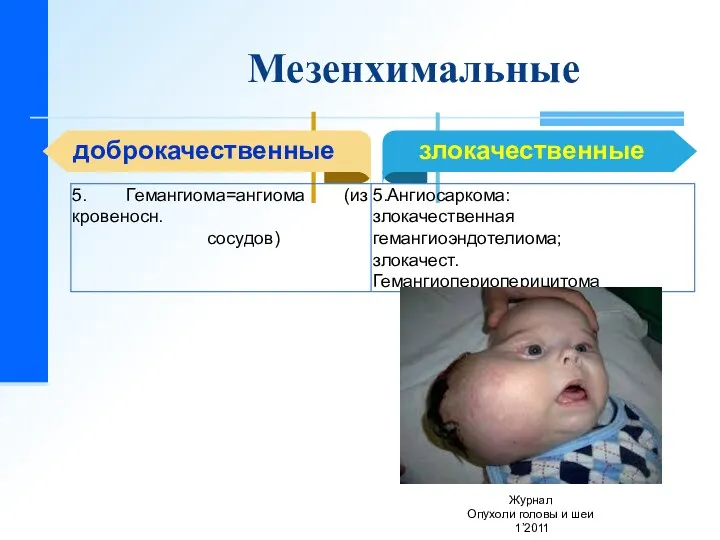 Мезенхимальные доброкачественные Журнал Опухоли головы и шеи 1’2011