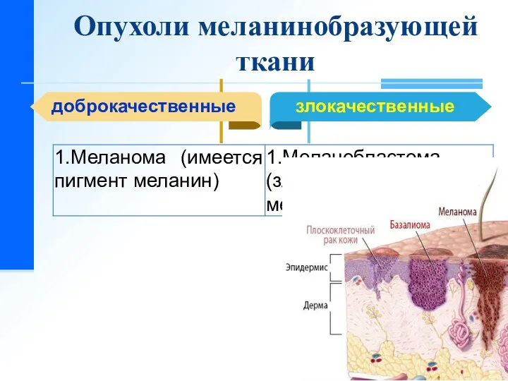 Опухоли меланинобразующей ткани доброкачественные