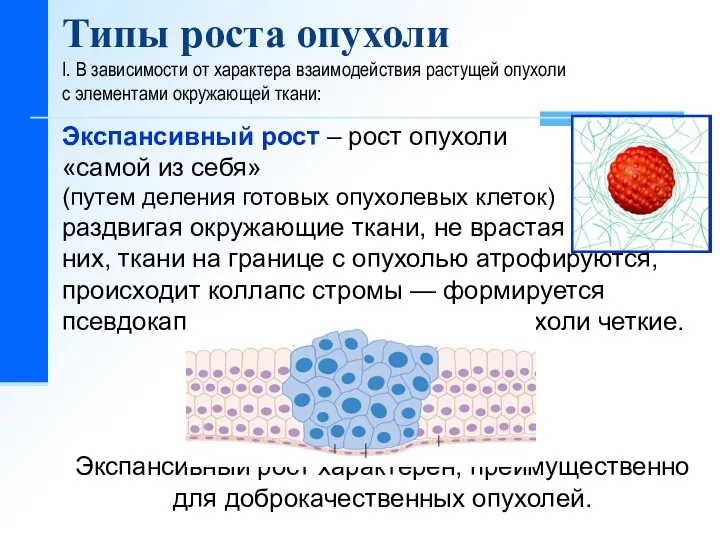 Типы роста опухоли I. В зависимости от характера взаимодействия растущей