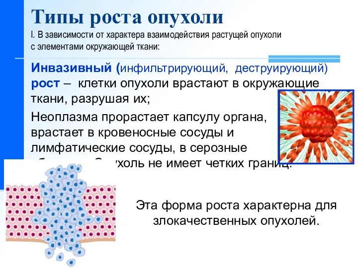 Типы роста опухоли I. В зависимости от характера взаимодействия растущей