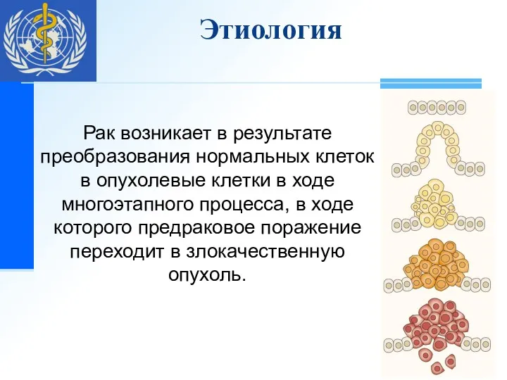 Рак возникает в результате преобразования нормальных клеток в опухолевые клетки