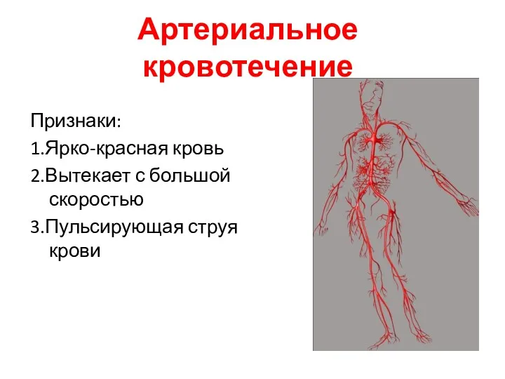 Артериальное кровотечение Признаки: 1.Ярко-красная кровь 2.Вытекает с большой скоростью 3.Пульсирующая струя крови