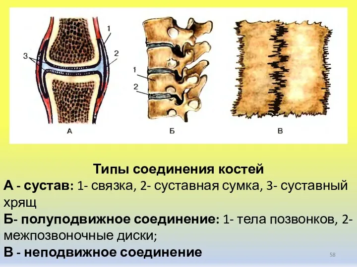 Типы соединения костей А - сустав: 1- связка, 2- суставная