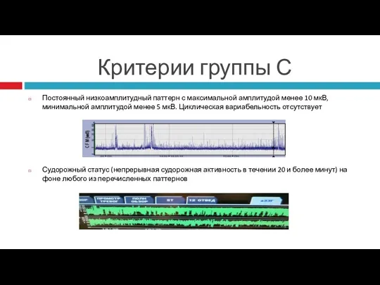 Критерии группы С Постоянный низкоамплитудный паттерн с максимальной амплитудой менее