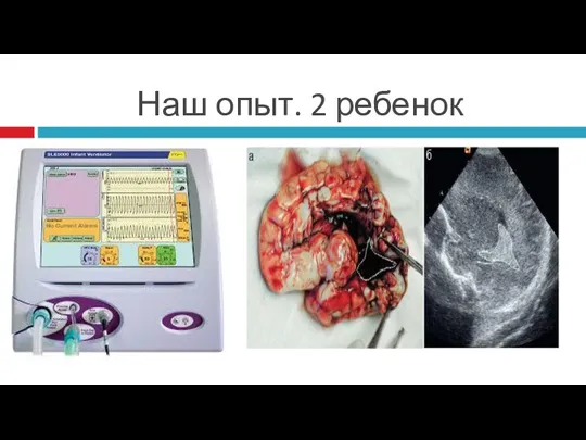 Наш опыт. 2 ребенок