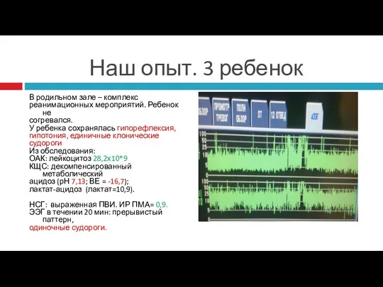 Наш опыт. 3 ребенок В родильном зале – комплекс реанимационных