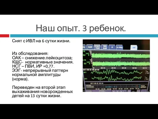 Наш опыт. 3 ребенок. Снят с ИВЛ на 6 сутки