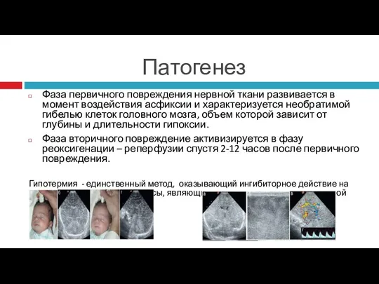 Патогенез Фаза первичного повреждения нервной ткани развивается в момент воздействия