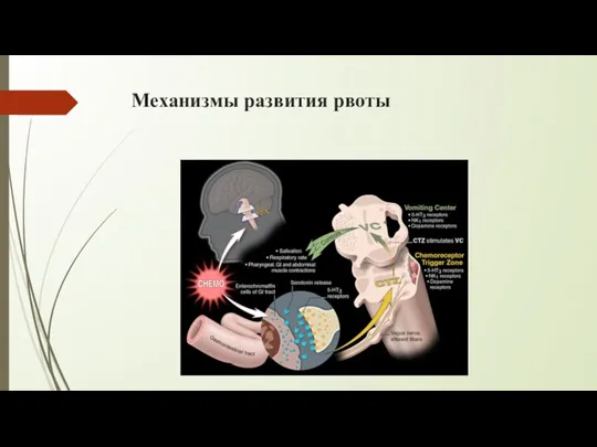 Механизмы развития рвоты