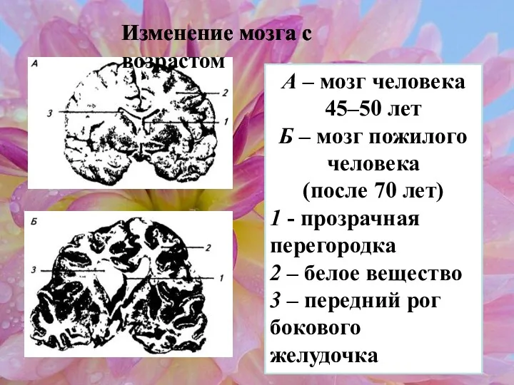 Изменение мозга с возрастом А – мозг человека 45–50 лет