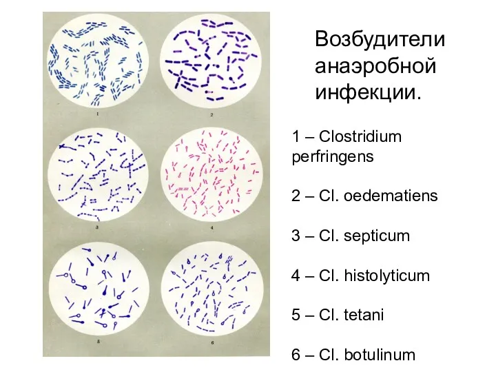 Возбудители анаэробной инфекции. 1 – Clostridium perfringens 2 – Cl.