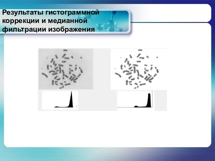 Результаты гистограммной коррекции и медианной фильтрации изображения