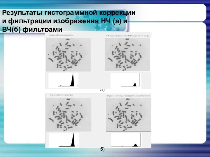 Результаты гистограммной коррекции и фильтрации изображения НЧ (а) и ВЧ(б) фильтрами а) б)