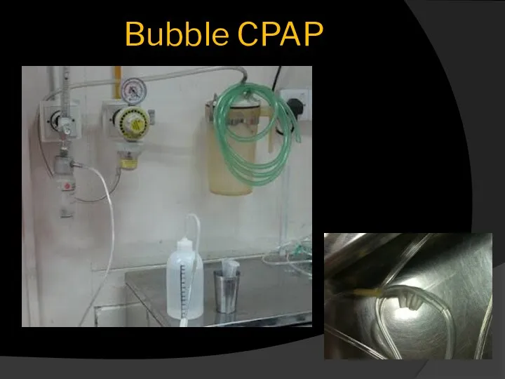 Bubble CPAP