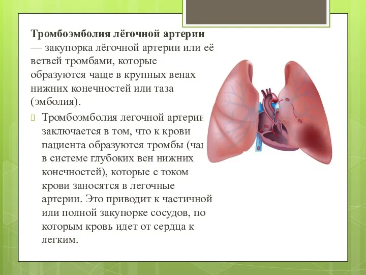 Тромбоэмболия лёгочной артерии — закупорка лёгочной артерии или её ветвей