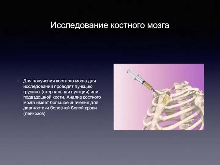 Исследование костного мозга Для получения костного мозга для исследований проводят