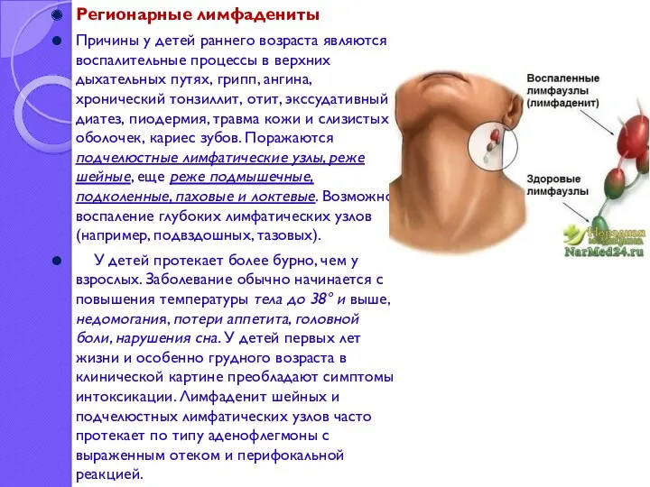 Регионарные лимфадениты Причины у детей раннего возраста являются воспалительные процессы