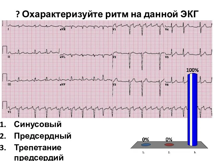 ? Охарактеризуйте ритм на данной ЭКГ Синусовый Предсердный Трепетание предсердий