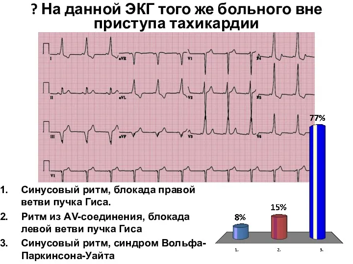 ? На данной ЭКГ того же больного вне приступа тахикардии Синусовый ритм, блокада