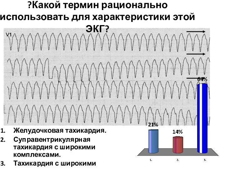 ?Какой термин рационально использовать для характеристики этой ЭКГ? Желудочковая тахикардия. Суправентрикулярная тахикардия с