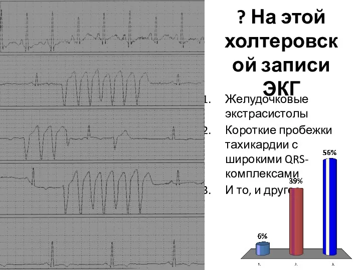 ? На этой холтеровской записи ЭКГ Желудочковые экстрасистолы Короткие пробежки