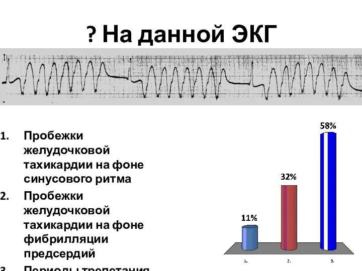 ? На данной ЭКГ Пробежки желудочковой тахикардии на фоне синусового ритма Пробежки желудочковой