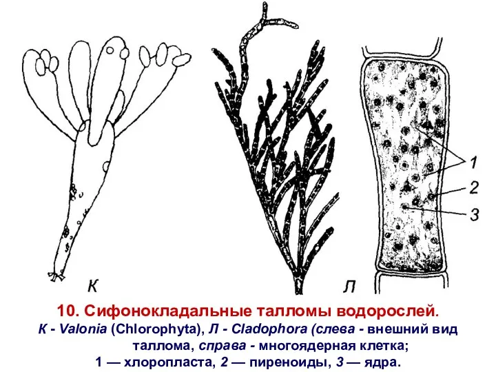 10. Сифонокладальные талломы водорослей. К - Valonia (Chlorophyta), Л -